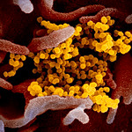 Novel Coronavirus SARS-CoV-2, Image Credit: NIAID-RML